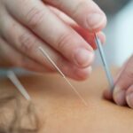 Le choix d’un bon acupuncteur